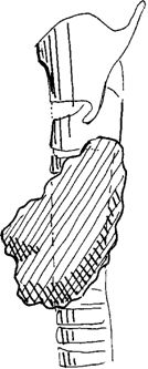 Kehlkopf, Seitenansicht